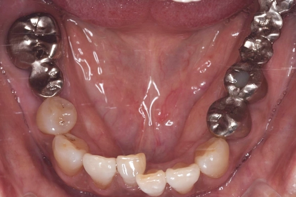 矯正治療の様子